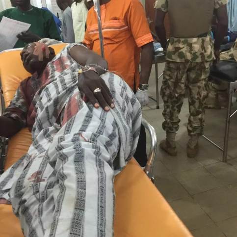 An injured UN official receiving treatment after the Boko Haram attack. Photo credits: Daily Post. 